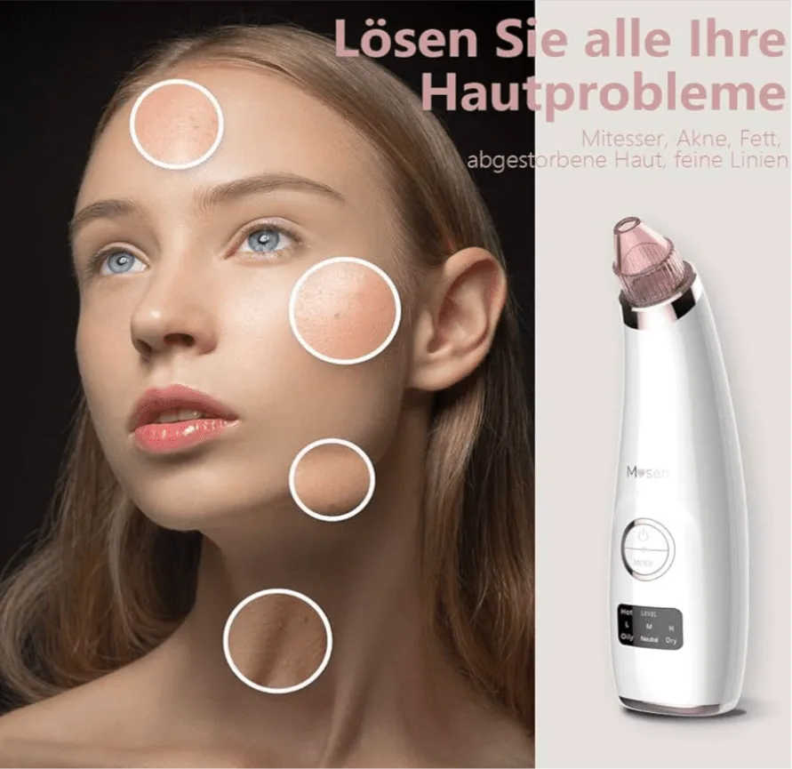Porenreiniger mit Vakuum – Mitesserentferner & Tiefenreinigung fürs Gesicht - Glanzhaut