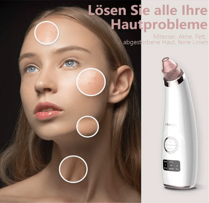 Porenreiniger mit Vakuum – Mitesserentferner & Tiefenreinigung fürs Gesicht - Glanzhaut