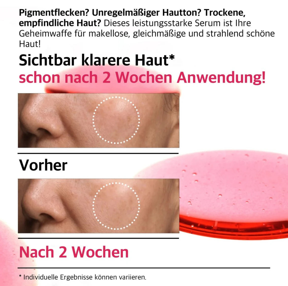 Anua Niacinamide 10 % + TXA 4 % Serum