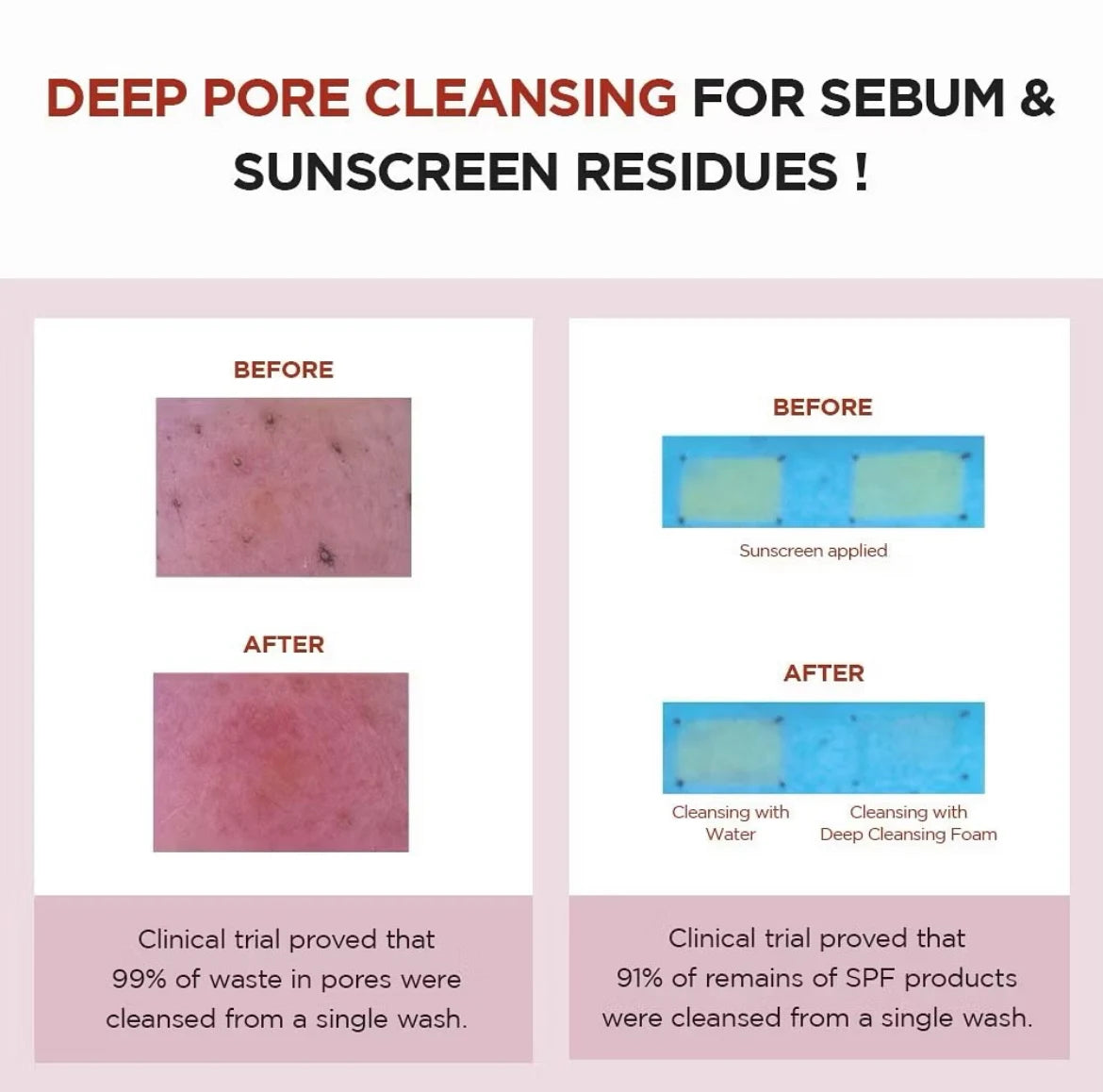 Skin1004 Madagascar Centella Poremizing Deep Cleansing Foam – 125 ml